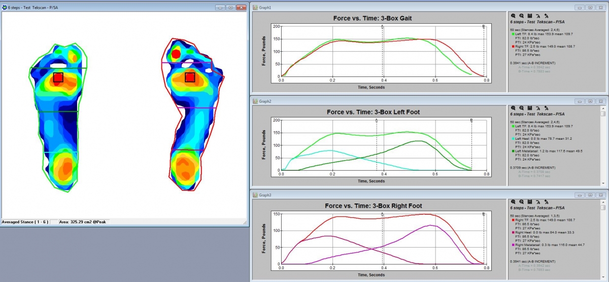 MobileMat HR provides essential insights for plantar pressure analysis and foot function.