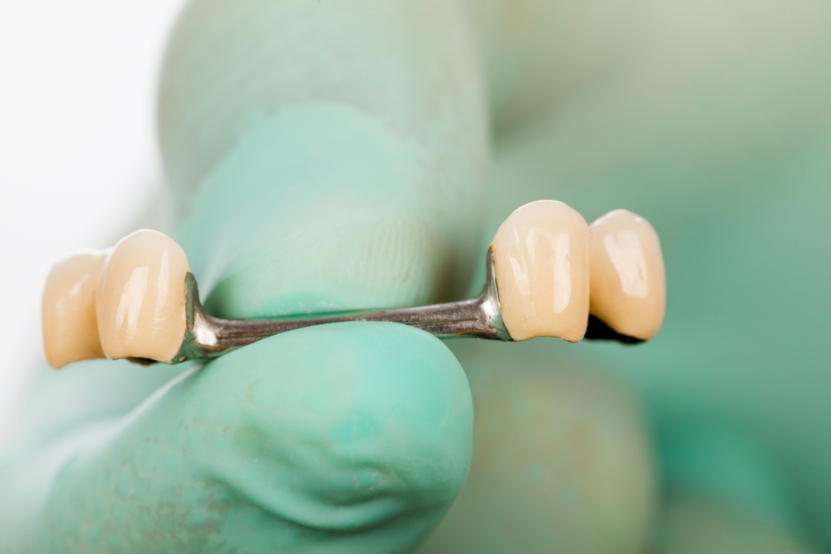 T-Scan is used to give dentists data that reveals the occlusal dynamics of the bite to ensure the longevity of prosthetic work