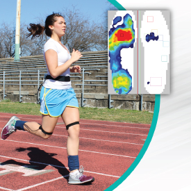 F-Scan: Complete Foot Function Analysis, Straight from the Sole