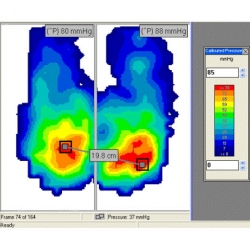 Identify areas of high pressure with the CONFORMat.