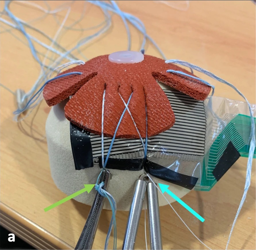 Rotator cuff repair simulation with tekscan sensor (via Journal of Experimental Orthopaedics)