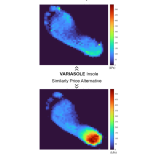 Variasole pressure distribution insole data