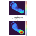 Variasole pressure distribution insole data